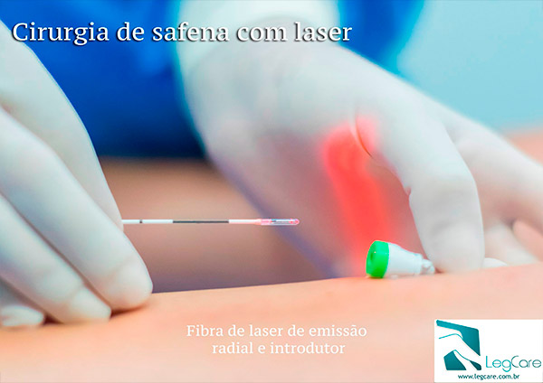 Endolaser Safena em São Paulo