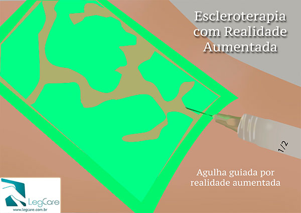 Realidade Aumentada VeinViewer