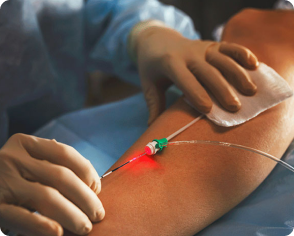 Cirurgia de safena a laser em São Paulo