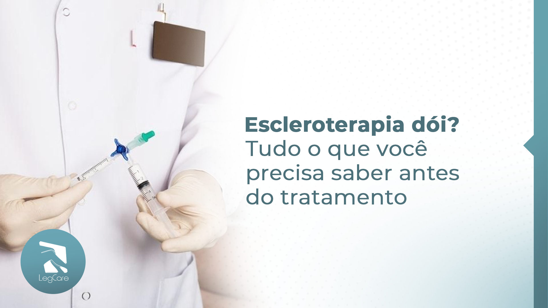 Escleroterapia dói? Tudo o que você precisa saber antes do tratamento
