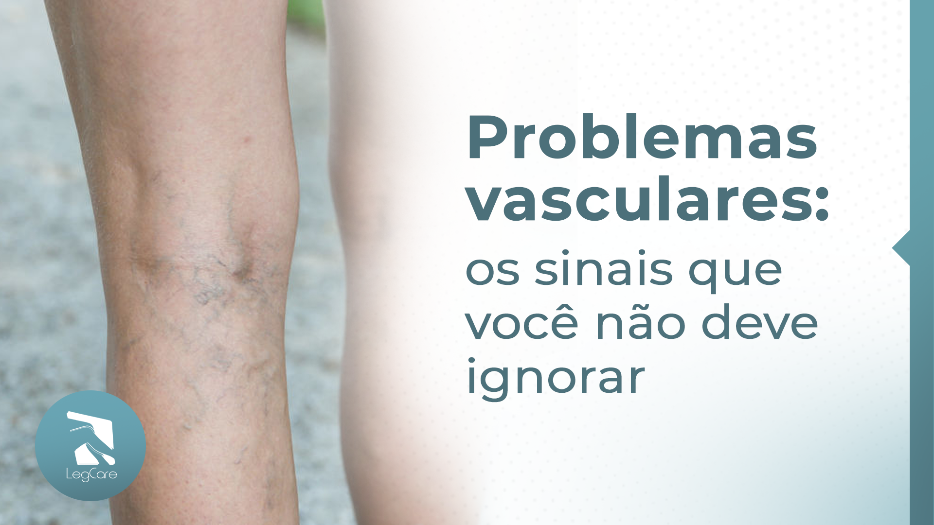 Problemas vasculares em São Paulo: sinais que você não deve ignorar