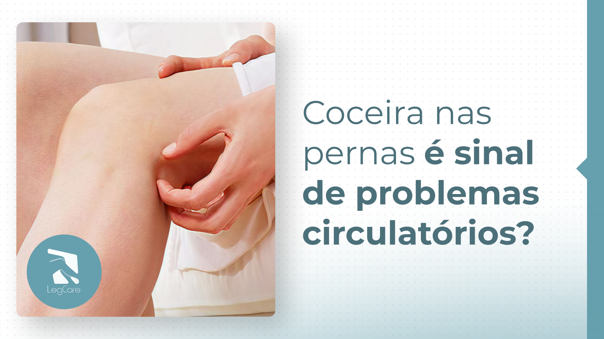 Coceira nas pernas é sinal de problemas circulatórios?