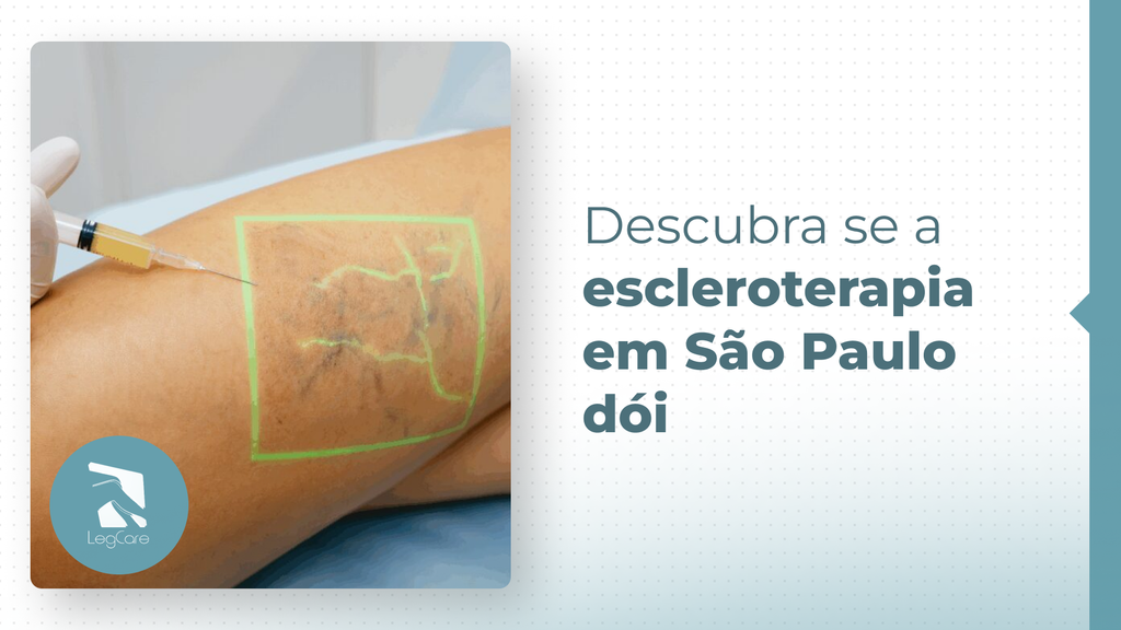 Descubra se escleroterapia em São Paulo Dói