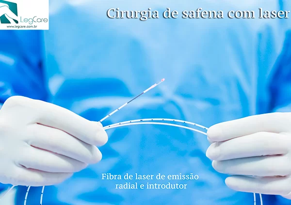 Laser Transdérmico para tratamento de varizes em SP